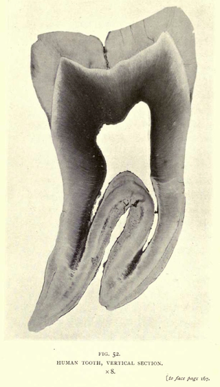 Illustration for article titled 110 Years Ago, These Microscopic Photos Horrified Londoners